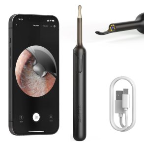 Bebird X0 Black | Otoscope with Ear Cleaning Camera | 1080p