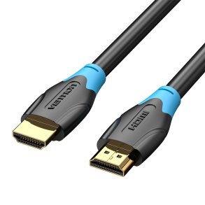 Vention AACBH HDMI-kabel 2 m HDMI Type A (Standard) Sort